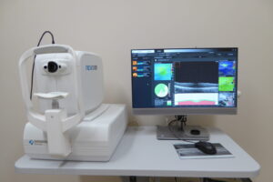 P1010039 Scaning laserowy do badania OCT oka